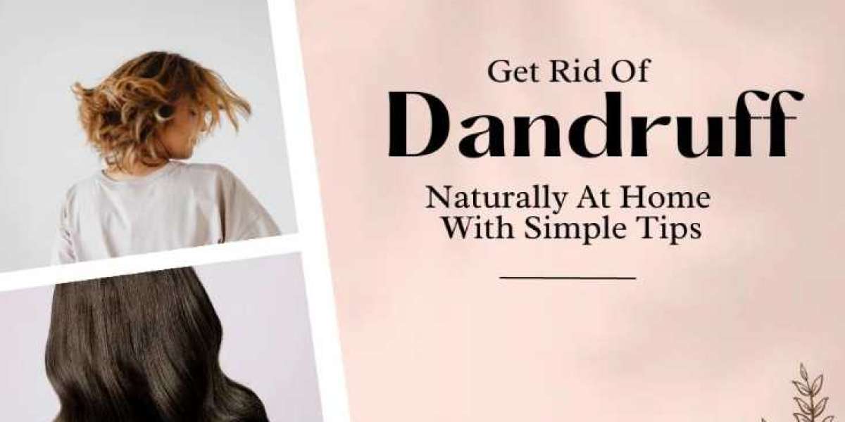 Natural Methods to Eliminate Dandruff Once and for All for a Healthy Scalp