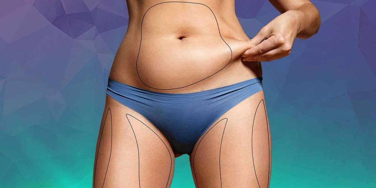 What is the Average Recovery Period for Liposuction?